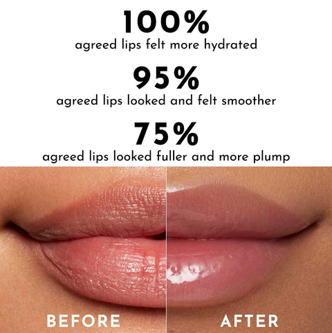Plumping effect with a natural shin