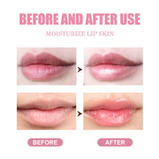 Honey-powered lip care