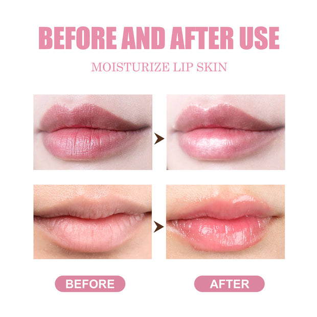 Honey-powered lip care