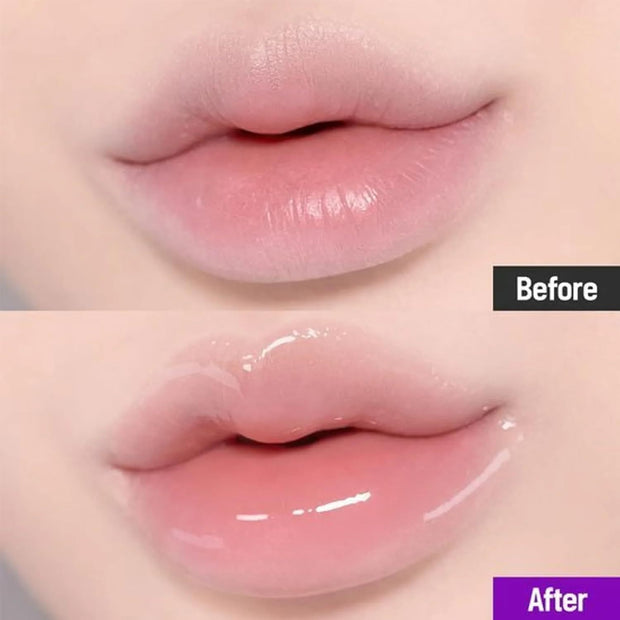 Probioderm Lip Balm – 15 ml Deep Moisture
